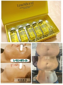 カラーリリー(calla lily)/脂肪分解美容液【レモンボトル】