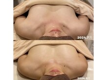 ジョリー(Jolie)/