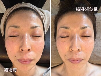 オラ(Ola)/40代/60分後