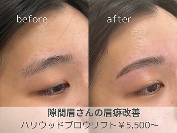 リモア(REMORE)/ハリウッドブロウリフト