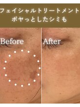 ココロ(COCORO)/シミケア＆美白トーニング