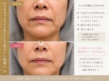 マグノリア(Magnolia)の雰囲気(【ほうれい線ケア】口元のもたつきをEMSでケア♪すっきり印象へ)