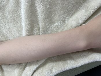 ナノハナ/鹿沼市全身脱毛美容室ナノハナ