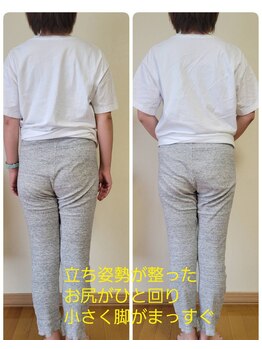 ソウラ(SOURA)/フェムケア矯正