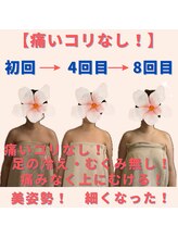 ミトラ(MITRA)/コリが楽になって全身軽い！