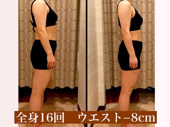 サロン セドナ(SALON SEDONA)/デトックス痩身 16回コース