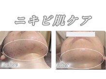 サロンデュ ひゃーく(Salon du ひゃーく)/～本気で変えたい方はこちら～