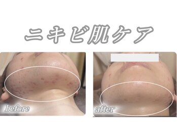 サロンデュ ひゃーく(Salon du ひゃーく)/～本気で変えたい方はこちら～