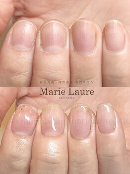 マリーロール 天王寺店(Marie Laure)/自爪育成/深爪矯正/ネイルケア