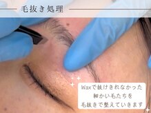 ママ バイ リディーヴ 川崎店(MAMA by Ridive)/施術の流れ5＊毛抜き処理