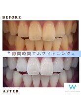 ホワイトニングショップ 葛西店/歯科提携 ホワイトニング専門店