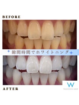 ホワイトニングショップ 葛西店/歯科提携 ホワイトニング専門店