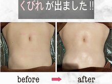 ナチュラーレ 京都四条烏丸店(Naturale)/リンパマッサージ痩身ダイエット