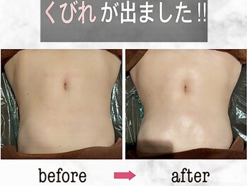 ナチュラーレ 京都四条烏丸店(Naturale)/リンパマッサージ痩身ダイエット