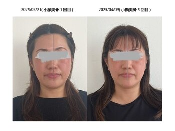 ルームドレ(room doree)/