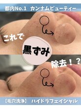 カンナムビューティー 新宿 代々木 毛穴洗浄 ハイドラ