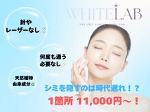 最新技術でシミを一回で除去♪