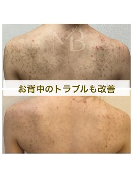 モカフォーブライダル(MOKA FOR BRIDAL)/