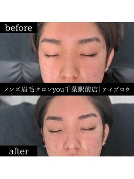ユー 千葉駅前店(you)/ビフォ－アフター写真