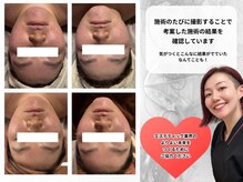 ビーディーラボ(B.D.Labo)の雰囲気（脱毛/毛穴/フェイシャル/顔脱毛/小顔/うなじ/木場/門前仲町/葛西）