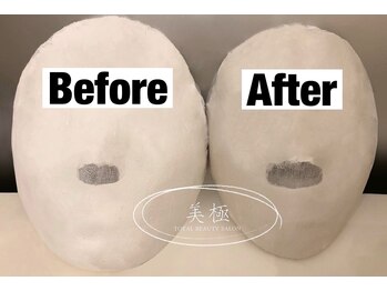 美極 銀座店/銀座/小顔コルギ/小顔矯正