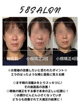 コアサロン(58SALON)/小顔矯正Before After