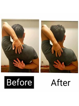 アース エンジェル整体院/ビフォアフ 肩甲骨ボディケア