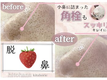 ヒトハナ(hitohana)/ツルピカ♪強力吸引！脱いちご鼻