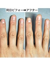 桃の木 吉祥寺店/爪周りすっきり