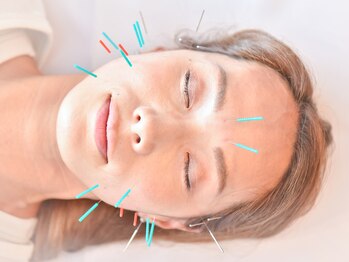 ヤマノ(YAMANO)/お顔の美容鍼