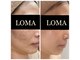 クリニカルエステ(Salon de LOMA reve beaute)の写真