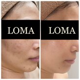 クリニカルエステ(Salon de LOMA reve beaute)