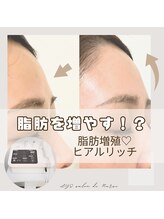 リスサロンドナース(LYS salon de Nurse)/自分の脂肪増やす！ヒアルリッチ
