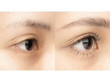 アイビー(eyebee)/