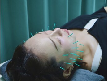 エン鍼灸整骨院 青山一丁目院(En鍼灸整骨院)の写真/慢性的で頑固なコリや身体の不調改善♪丁寧な施術で初めての方にもオススメ!自律神経からととのえる美容鍼