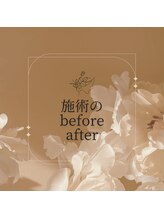 ラ フェリーチェ(La Felice)/施術のbefore after