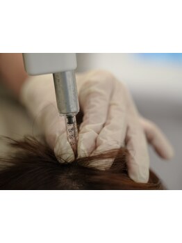 ヘッドスパで癒されたい