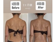 リトリート(Retreat)/1回目Before→2回目After