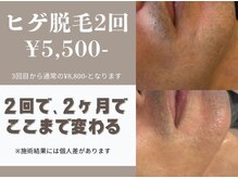 ビューティー サロン アズール(BEAUTY SALON AZUL)