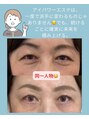 サロンドグリッター 国分店(salon de glitter) 全国で選ばれたサロン限定のアイパワーエステで目元悩み解消