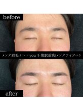 ユー 千葉駅前店(you)/ビフォ－アフター写真