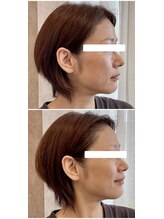 ニコワ(Nicowa)/Nicowaのコルギ★BeforeAfter