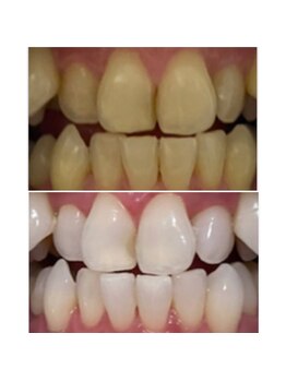 スタンド 尼崎武庫之荘店(STAND)/