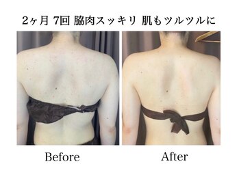 ナチュラーレ 天王寺店(Naturale)/痩身リンパマッサージ二の腕美脚