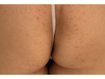 シド/誰にも言えないヒップケアも改善