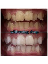 ホワイトニングショップ 南堀江店/セルフホワイトニング[堀江]