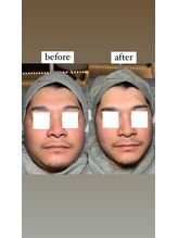 アエ(ae)/一度でむくみが取れてスッキリ♪