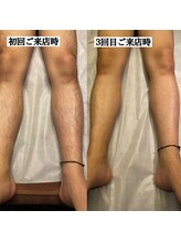 メンテ(MENTE)/最短最速で減らしたい