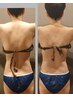 【首筋を長く・巻き肩・猫背姿勢を改善したい】上半身姿勢矯正　80分¥16800→