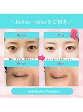 パチュプチ(Patchou petit)/若々しい目元になれるパークアイ